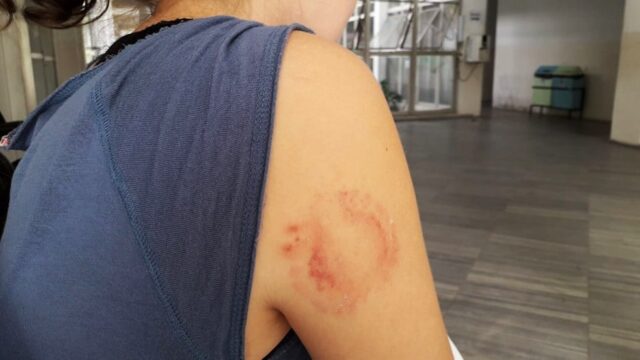 mordida (1)
