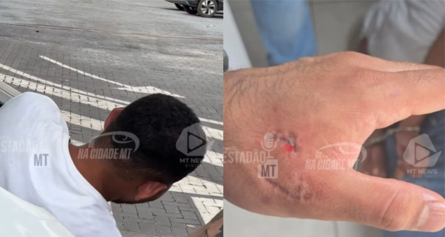 homem-preso-em-sorriso-morde-policial